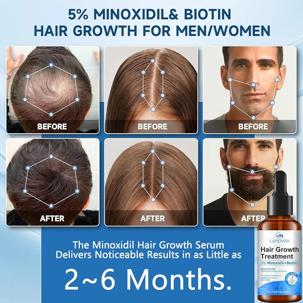 Minoxidil Hair Growth Serum 5% – Hair Fall Control & Strengthening
