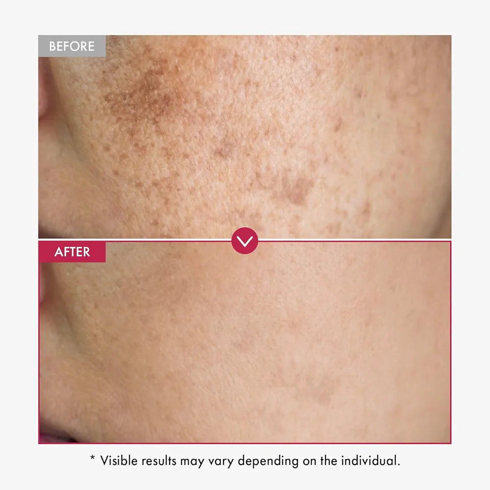 Tosowoong Niacinamide 10% + TXA 4% Serum – Brightening & Hydrating (33ml)