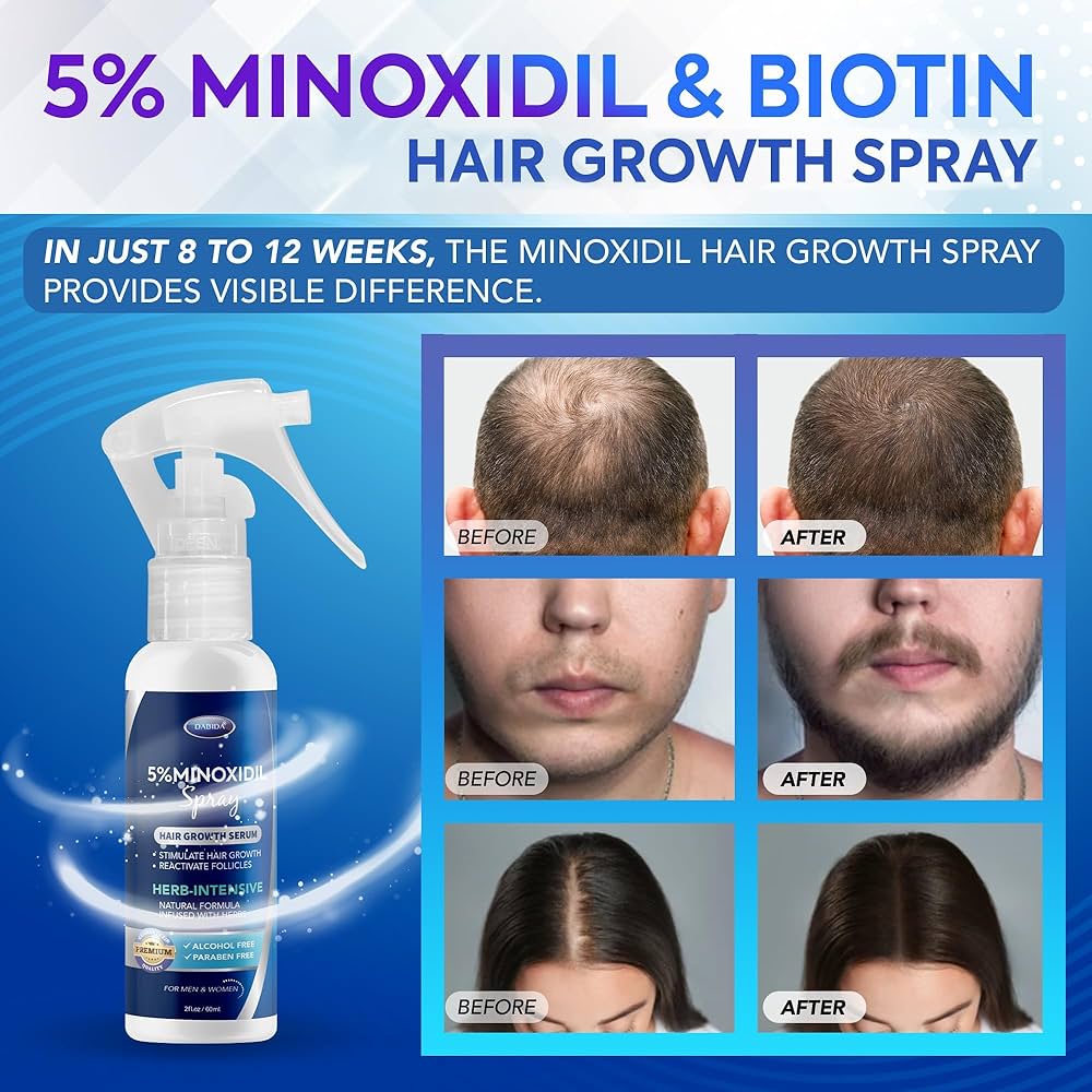 Minoxidil 5% Hair Growth Spray for Men – Fast Hair Regrowth & Beard Booster 120ml