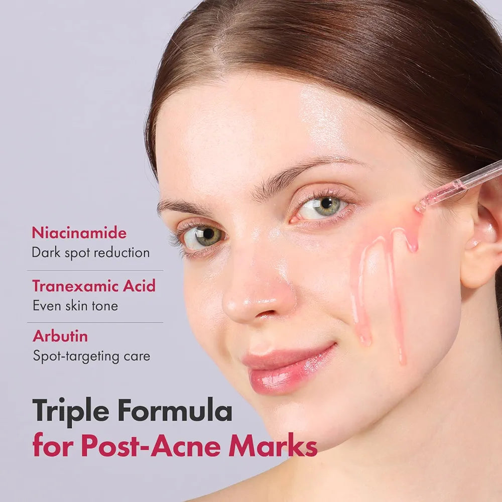 Tosowoong Niacinamide 10% + TXA 4% Serum – Brightening & Hydrating (33ml)